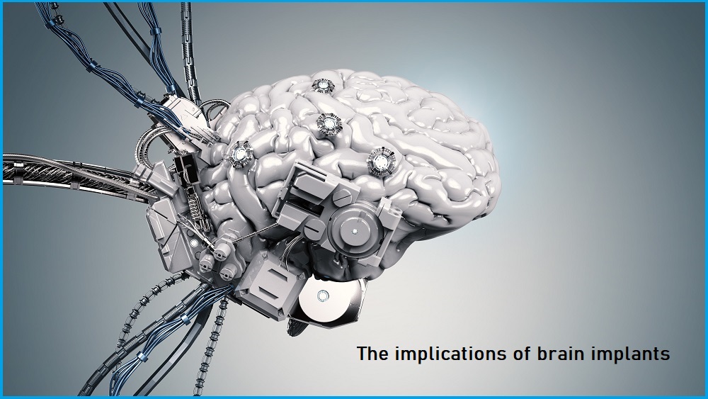 What happens to obsolete brain implants? | Information Age | ACS - ACS